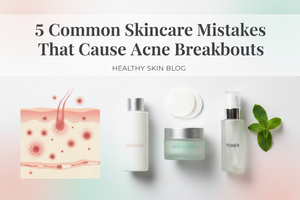5 Common Skincare Mistakes That Cause Acne Breakouts