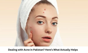 Dealing with Acne in Pakistan? Here’s What Actually Helps