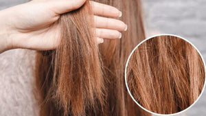 Hair Fall Prevention in Pakistan: Best Shampoos & Expert Tips