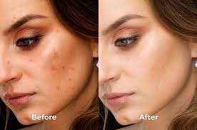 Does Glow White Cream Really Brighten Your Skin? Here's What You Need to Know